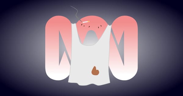 A sunburnt, wifebeating deadbeat ABC logo